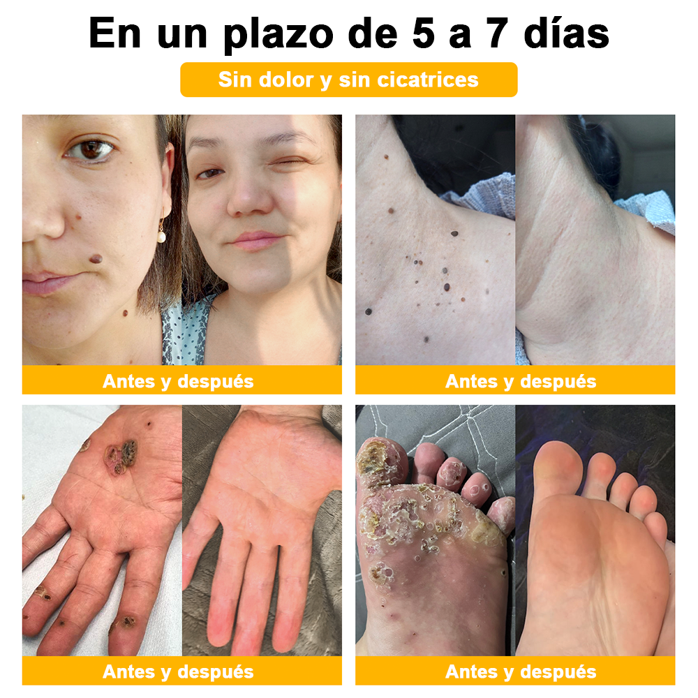 ðºðž ã¢ã¡ãªã«è£œã®å®å¿å質ð ð»ððððð⢠ããŒããã é
åã¹ãã³ã±ã¢ã¯ãªãŒã ã¯ãã¢ã¡ãªã«ç®èç§åŠäŒïŒAADïŒã«æšå¥šãããå®å掟ã¢ã€ãã ã§ã