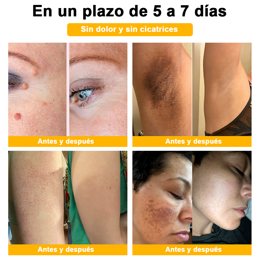 ðºðž ã¢ã¡ãªã«è£œã®å®å¿å質ð ð»ððððð⢠ããŒããã é
åã¹ãã³ã±ã¢ã¯ãªãŒã ã¯ãã¢ã¡ãªã«ç®èç§åŠäŒïŒAADïŒã«æšå¥šãããå®å掟ã¢ã€ãã ã§ã