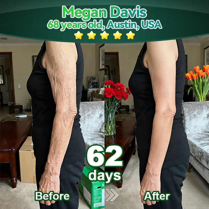 【代金引換だよ】𝐿𝑜𝑡𝑚𝑎𝑦® 幹細胞 と コラーゲンペプチド 経口 滴剤 💧 (たるんだ肌を引き締め、シワの形成を軽減) 🍀（副本）