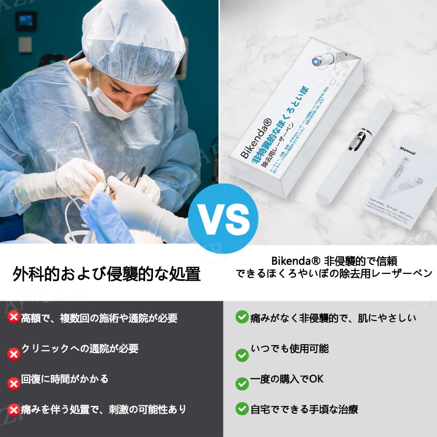 【代引きOK】Bikenda® 非侵襲レーザーペン｜自宅で安全にほくろ・いぼをケア🌸