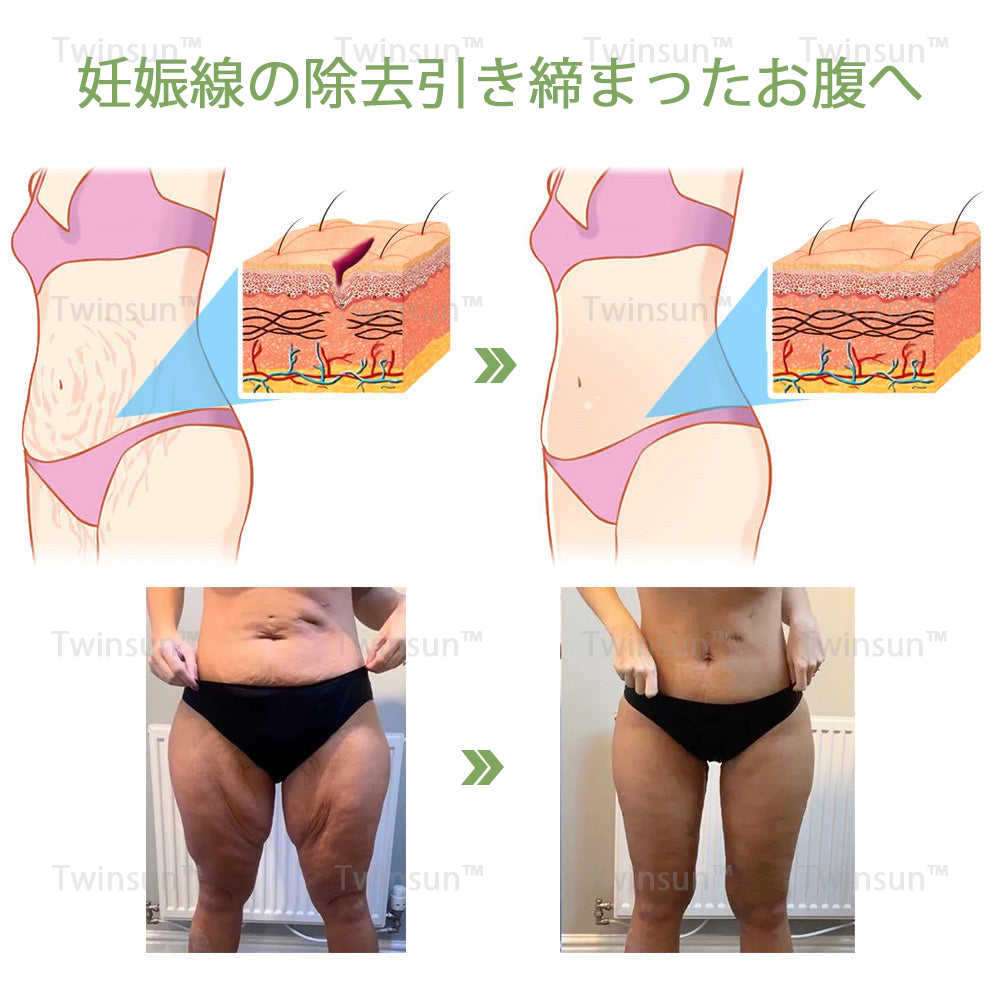 【安心の代引き対応】Twinsun™ 高級コラーゲン引き締めクリームで🔥今なら74％OFFでご提供中！💥