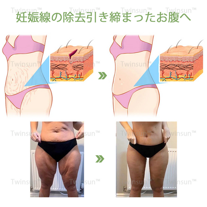 【安心の代引き対応】Twinsun™ 高級コラーゲン引き締めクリームで🔥今なら74％OFFでご提供中！💥