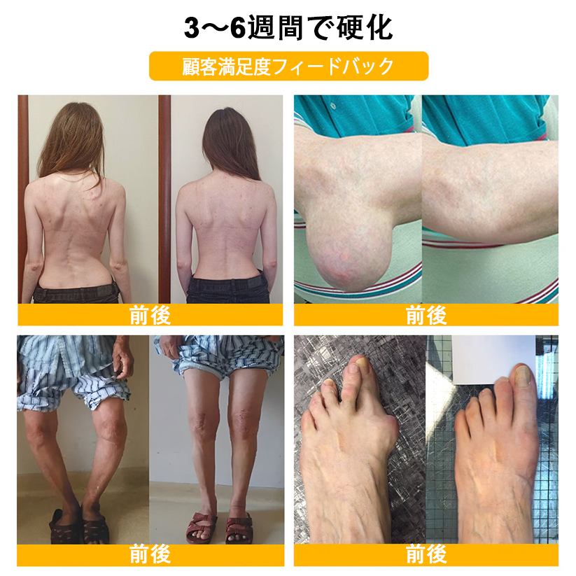 アメリカ製🇺🇸TLOPA® ボツリヌストキシン＆蜂毒 骨・関節サポートクリーム （👴高齢の方におすすめ！整形外科医も推奨✨）🐝