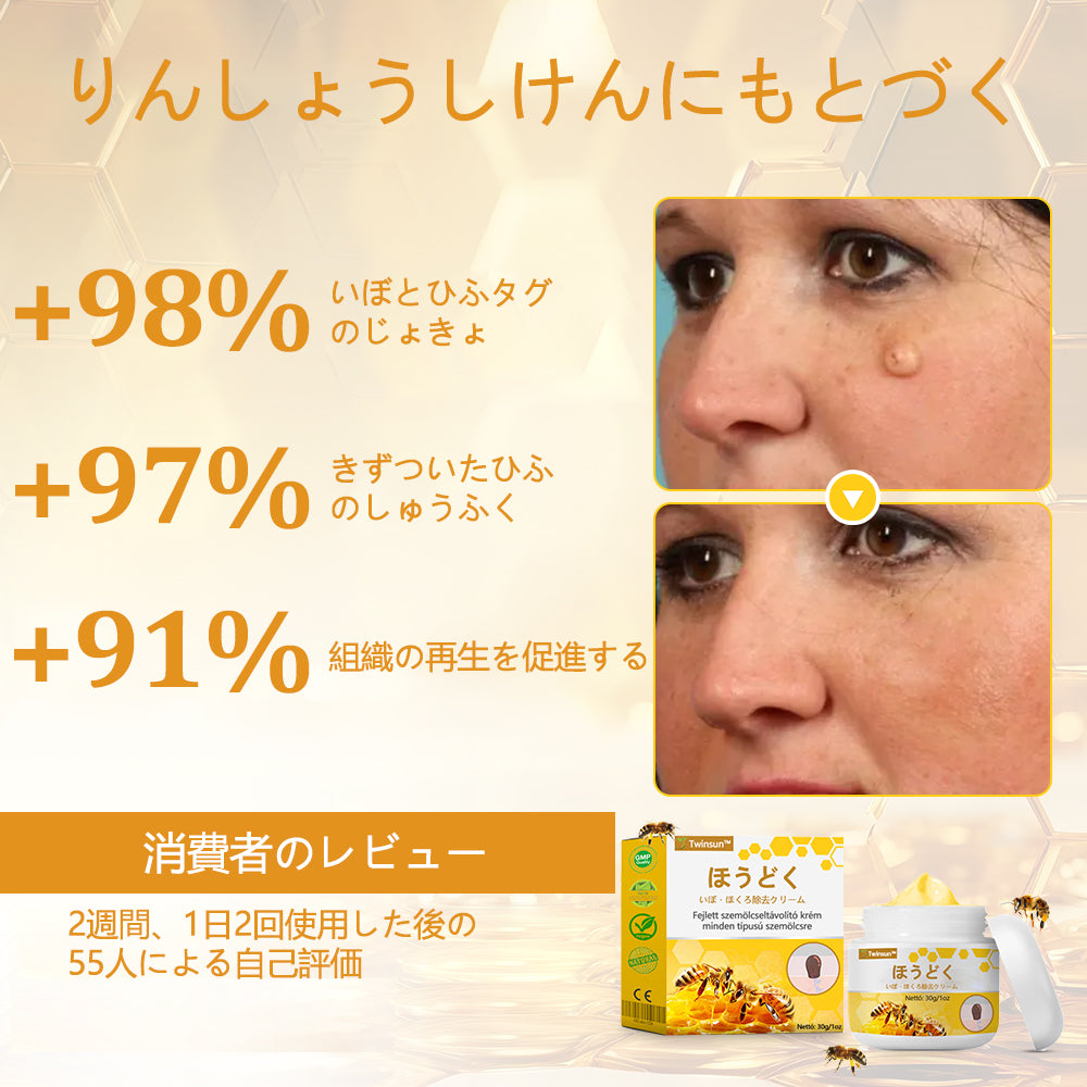🐝アメリカ製🇺🇸【代引きOK】Twinsun™超高濃度ビーベノム（蜂毒）配合クリーム！ 💖FDA認可取得済みの安心処方で、いぼ・皮膚の盛り上がり・感染・角化症、そしてゴワついた肌のケアにぴったり！