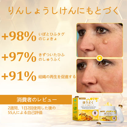 🐝アメリカ製🇺🇸【代引きOK】Twinsun™超高濃度ビーベノム（蜂毒）配合クリーム！ 💖FDA認可取得済みの安心処方で、いぼ・皮膚の盛り上がり・感染・角化症、そしてゴワついた肌のケアにぴったり！