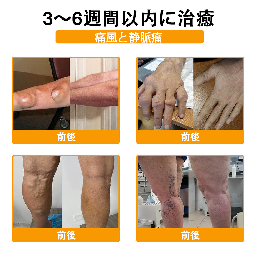 アメリカ製🇺🇸TLOPA® ボツリヌストキシン＆蜂毒 骨・関節サポートクリーム （👴高齢の方におすすめ！整形外科医も推奨✨）🐝