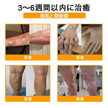 アメリカ製🇺🇸TLOPA® ボツリヌストキシン＆蜂毒 骨・関節サポートクリーム （👴高齢の方におすすめ！整形外科医も推奨✨）🐝