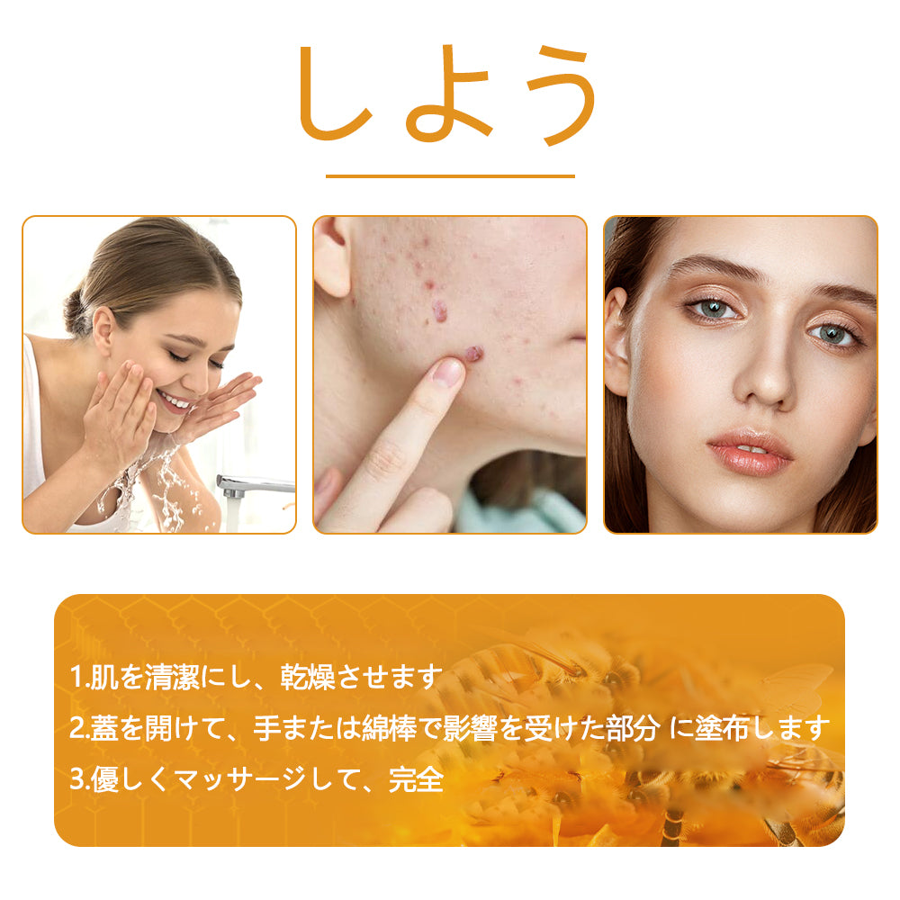 🐝アメリカ製🇺🇸【代引きOK】Twinsun™超高濃度ビーベノム（蜂毒）配合クリーム！ 💖FDA認可取得済みの安心処方で、いぼ・皮膚の盛り上がり・感染・角化症、そしてゴワついた肌のケアにぴったり！