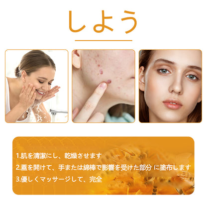 🐝アメリカ製🇺🇸【代引きOK】Twinsun™超高濃度ビーベノム（蜂毒）配合クリーム！ 💖FDA認可取得済みの安心処方で、いぼ・皮膚の盛り上がり・感染・角化症、そしてゴワついた肌のケアにぴったり！