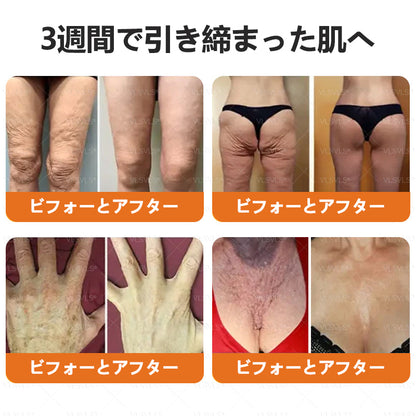 VLSVLS™ 蜂毒配合スキンクリーム（フルケアタイプ）🧑‍⚕️ 皮膚科医も推薦！ 肌トラブル全般に対応した高機能クリームです