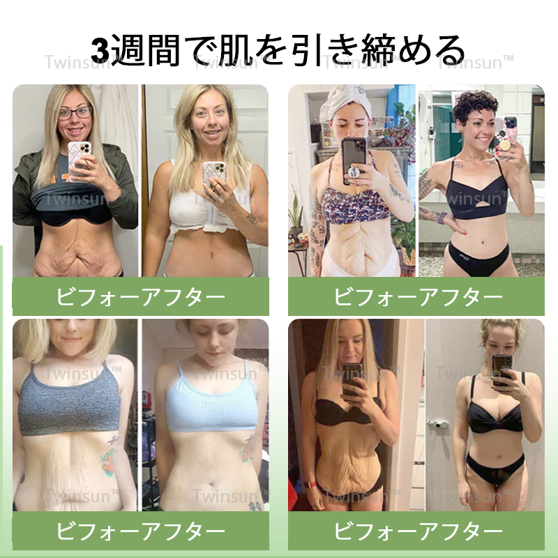 【安心の代引き対応】Twinsun™ 高級コラーゲン引き締めクリームで🔥今なら74％OFFでご提供中！💥