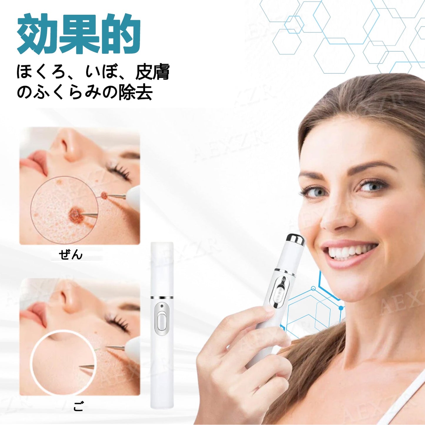 【代引きOK】Bikenda® 非侵襲レーザーペン｜自宅で安全にほくろ・いぼをケア🌸