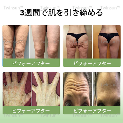 【安心の代引き対応】Twinsun™ 高級コラーゲン引き締めクリームで🔥今なら74％OFFでご提供中！💥