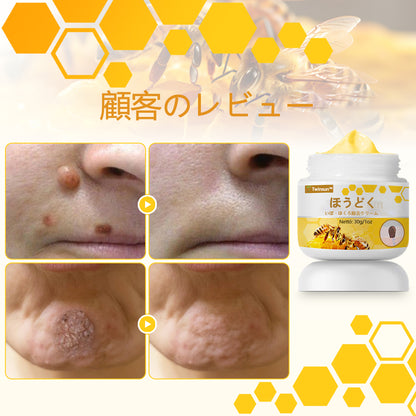 🐝アメリカ製🇺🇸【代引きOK】Twinsun™超高濃度ビーベノム（蜂毒）配合クリーム！ 💖FDA認可取得済みの安心処方で、いぼ・皮膚の盛り上がり・感染・角化症、そしてゴワついた肌のケアにぴったり！
