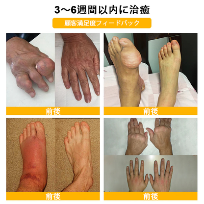アメリカ製🇺🇸TLOPA® ボツリヌストキシン＆蜂毒 骨・関節サポートクリーム （👴高齢の方におすすめ！整形外科医も推奨✨）🐝