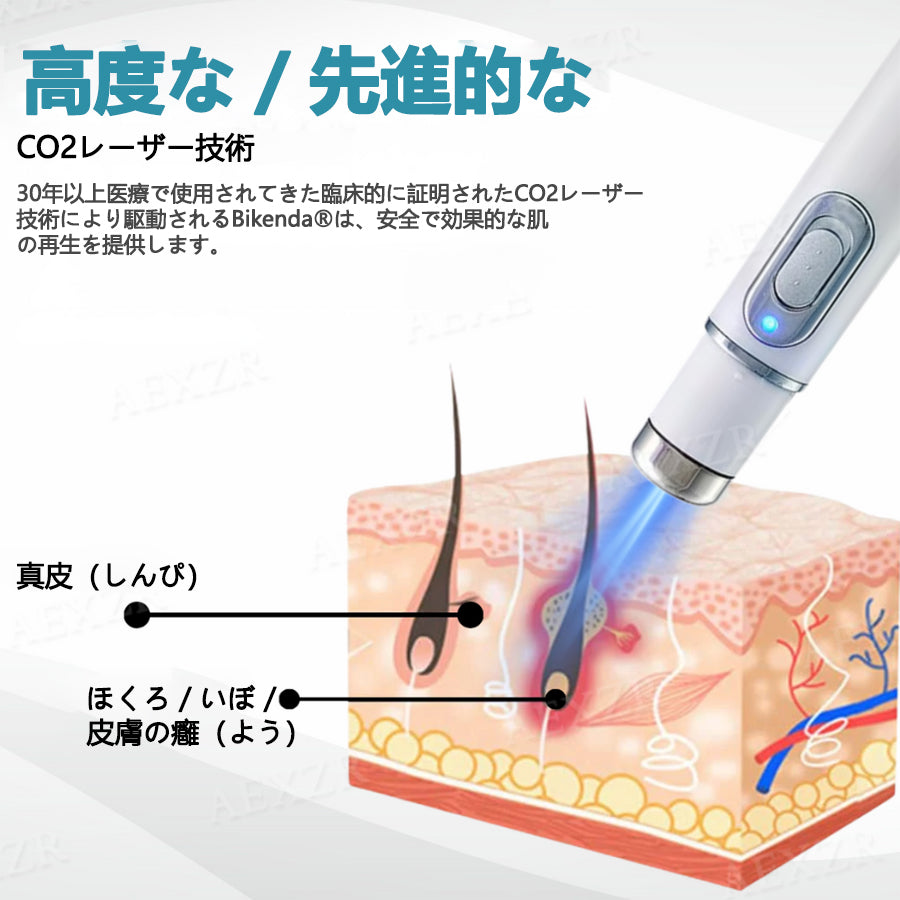 [代金引換] Bikenda® 非侵襲型レーザーペン 自宅で安全にシミ・イボを除去できる最新アイテム！💎