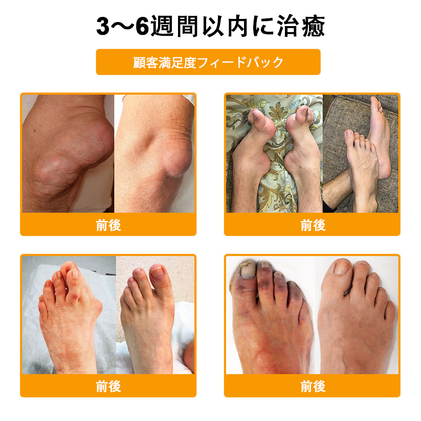 アメリカ製🇺🇸TLOPA® ボツリヌストキシン＆蜂毒 骨・関節サポートクリーム （👴高齢の方におすすめ！整形外科医も推奨✨）🐝