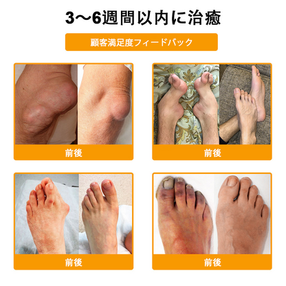 アメリカ製🇺🇸TLOPA® ボツリヌストキシン＆蜂毒 骨・関節サポートクリーム （👴高齢の方におすすめ！整形外科医も推奨✨）🐝
