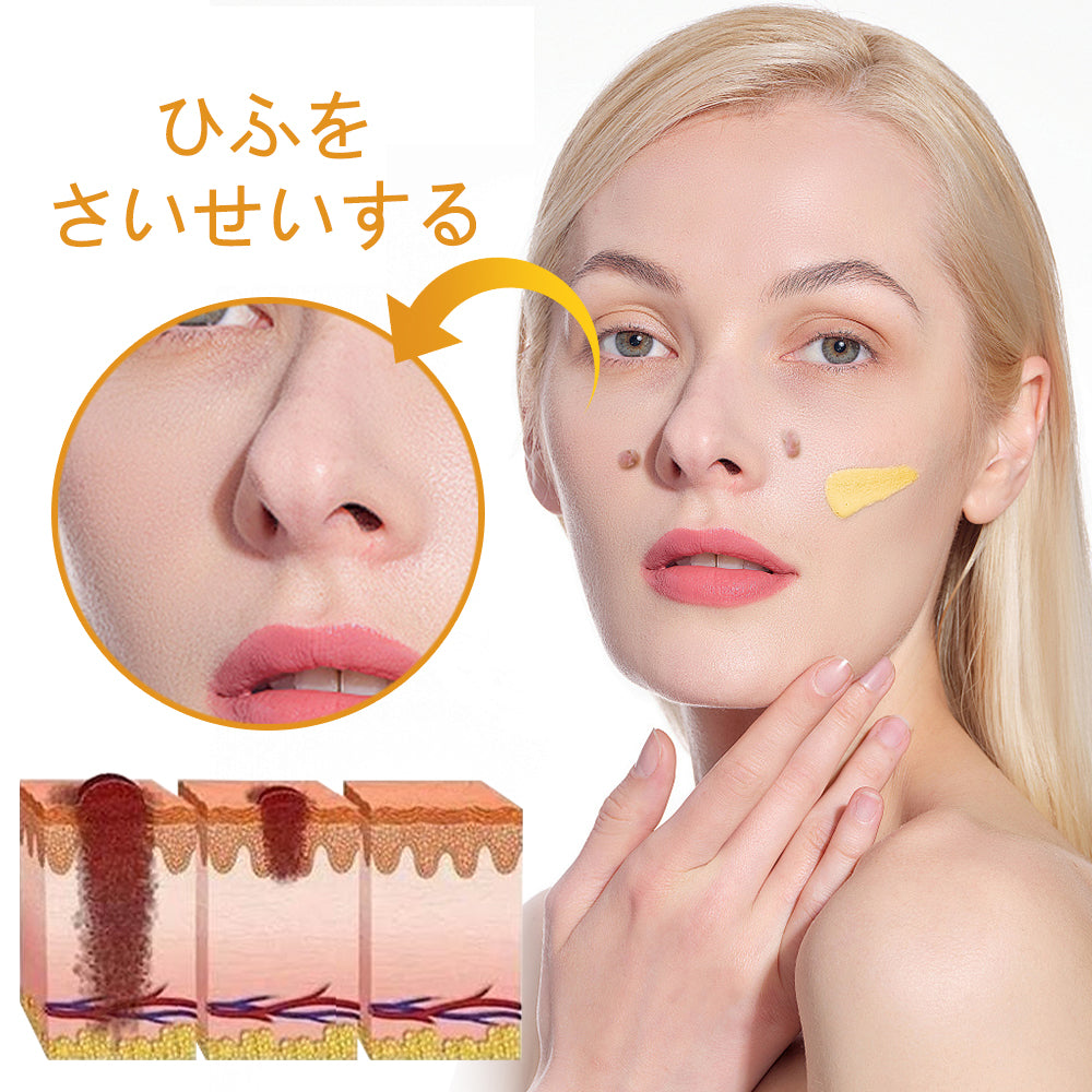 🐝アメリカ製🇺🇸【代引きOK】Twinsun™超高濃度ビーベノム（蜂毒）配合クリーム！ 💖FDA認可取得済みの安心処方で、いぼ・皮膚の盛り上がり・感染・角化症、そしてゴワついた肌のケアにぴったり！